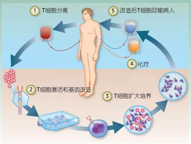 治疗白血病 除了砒霜还有什么？